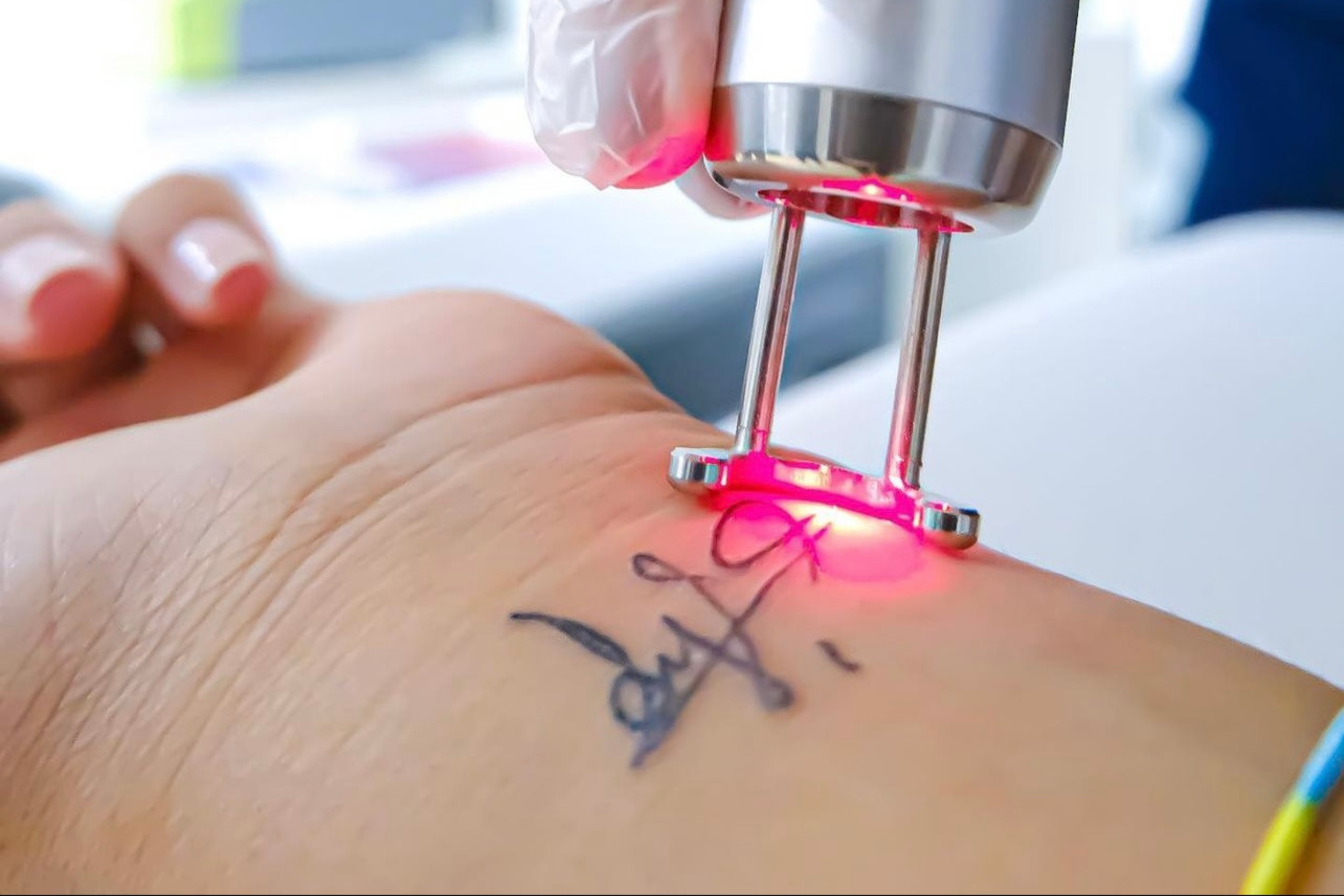 Q-Switch Laser